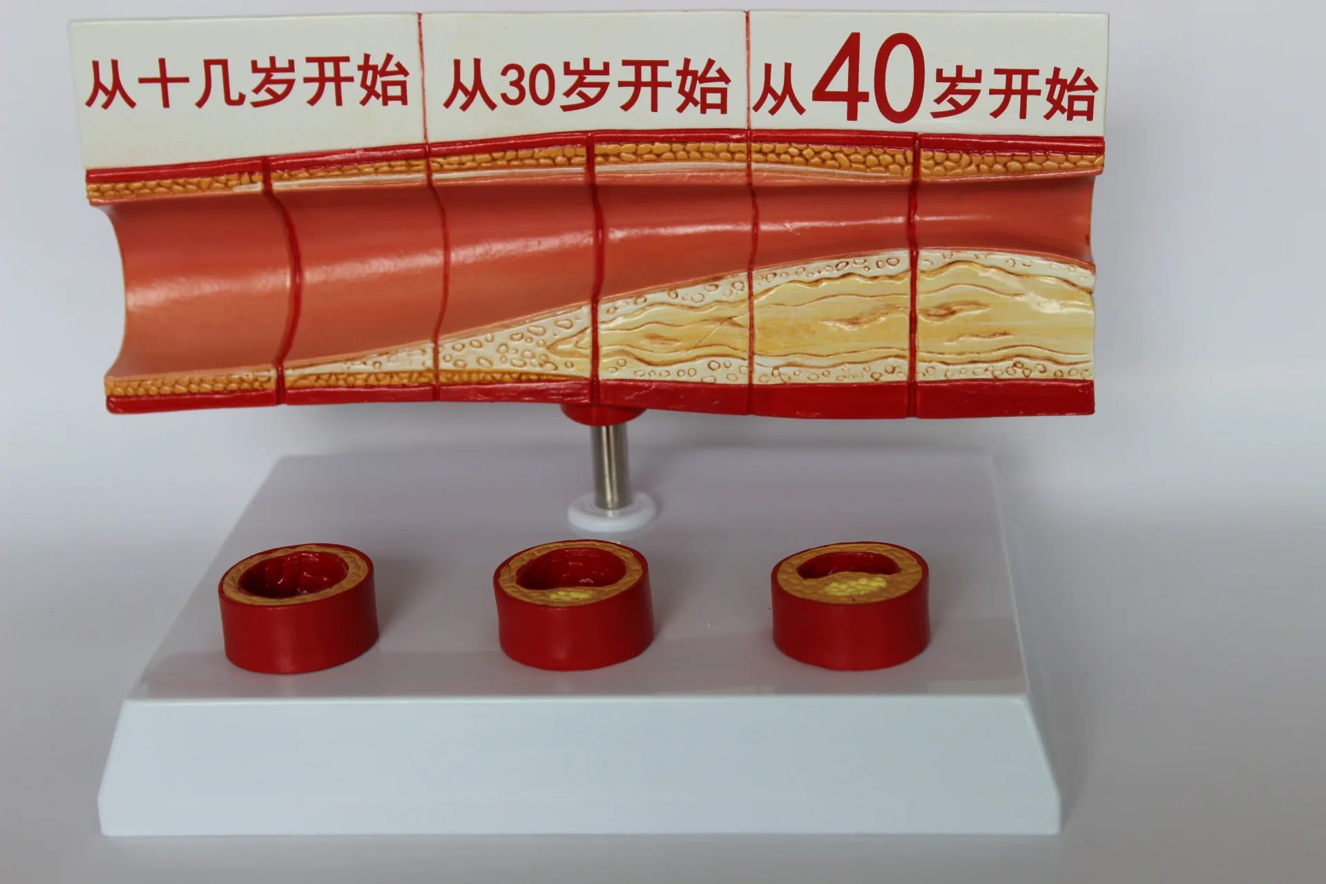 Модель липидного холестерина в крови и возрастная модель демонстрация