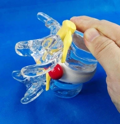 

Model of spinal and spinal compression Human medical medical teaching model free shipping