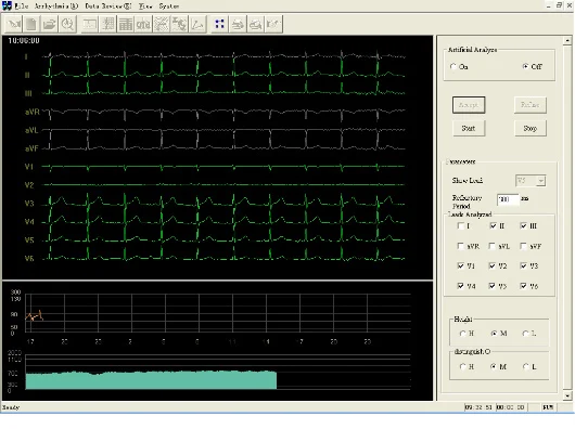 Система Holter TLC6000 Dynamic 12 Lead ECG 48 часов записи программное обеспечение для и
