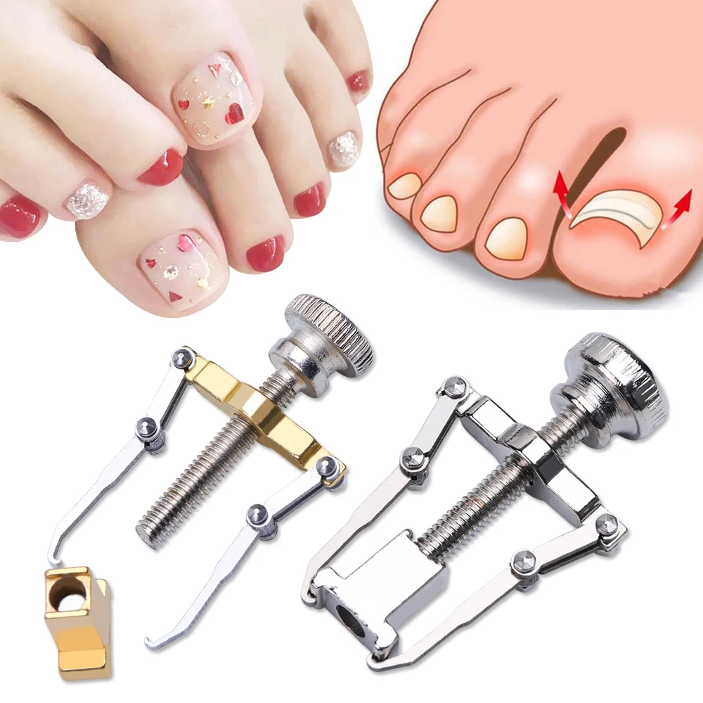 1 Набор корректоров для ног вросших ногтей педикюра пилок ухода за ногами Bunions
