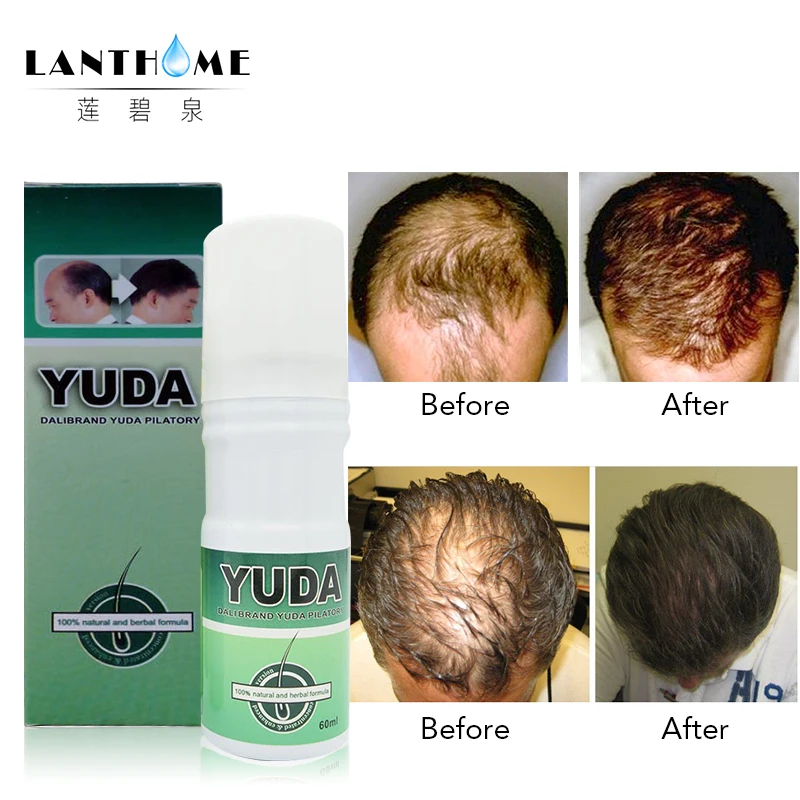 

Lanthome 3pcs Original hair growth Extra Strength Alopecia Hair Growth essence Treatment Hair Loss Products Hair Growth Spray