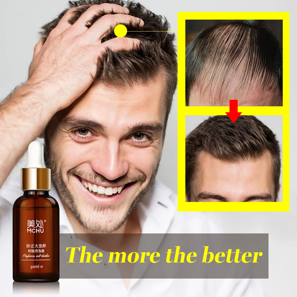 Масло для роста волос и ускоренный рост уход за продуктами выпадения натуральные