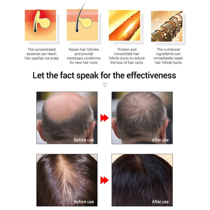 

Hair Growth Essential Oil Hair Care Hair Loss Prevention Products For Men and Women