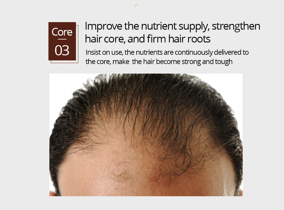 30ml Hair Growth Serum Essence Spray for Women and Men Anti Prevent Hair Loss alopecia Liquid Damaged Hair Growth Liquid