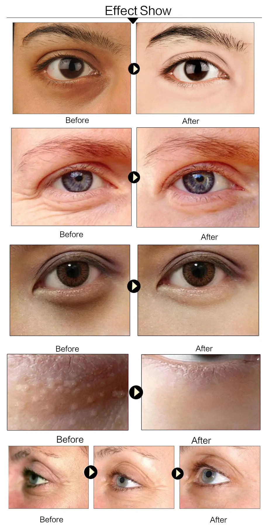 5/8/10/15packs Collagen Eye Mask Anti Aging Anti Puffiness Moisturizing Eye Masks Dark Circles Remover Eye Patches Gel Eye Pads