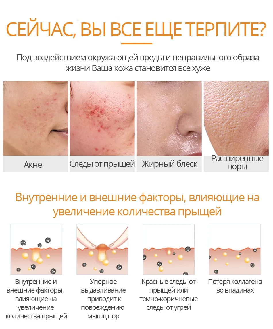 Яркие гламур салициловая кислота конденсации маска для ухода за кожей лечение для устранения акне масла Управление пигментации корректирующий крем