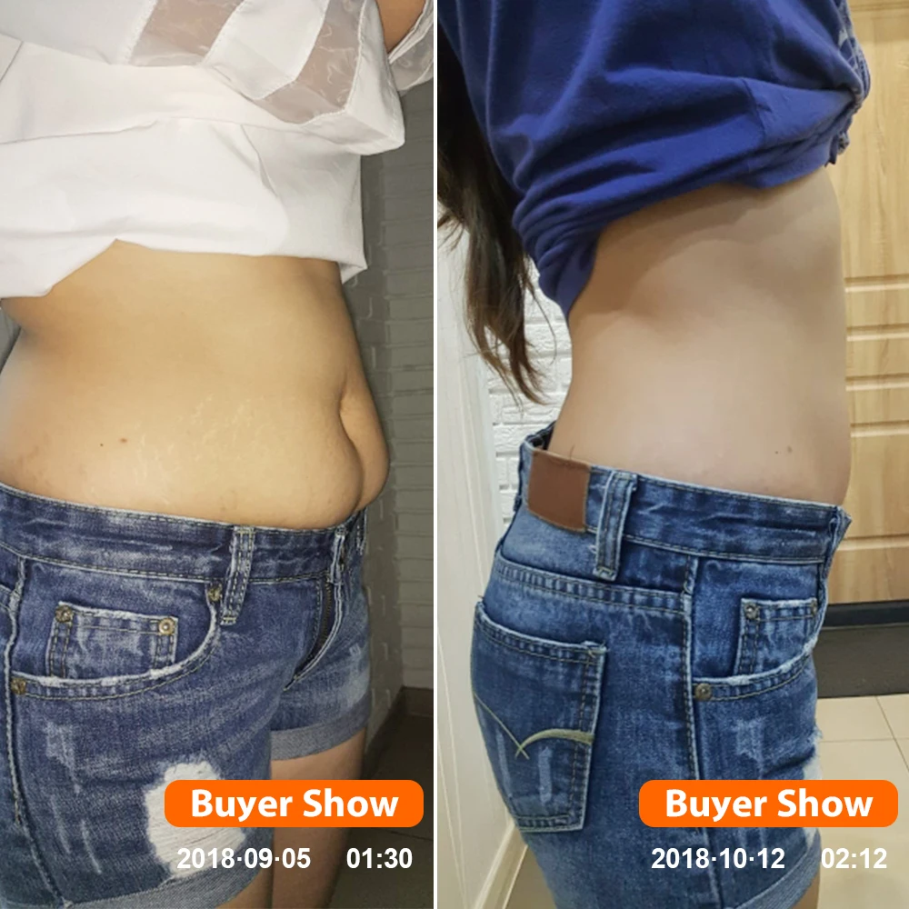 Фирменная наклейка для похудения ifory пластырь пупка 100 пластырей = 10 пакетов на