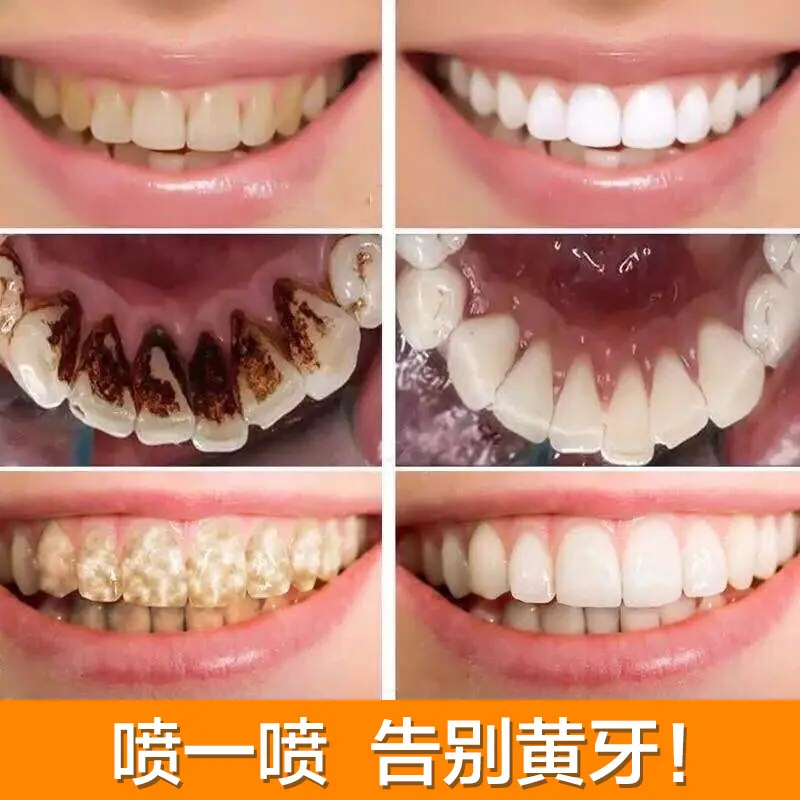 

Beautiful And Fresh Teeth Cleaning Mousse Pure Natural Tooth Brushing Whitener Detoxifying Dental Oral Hygiene Teeth Whitening