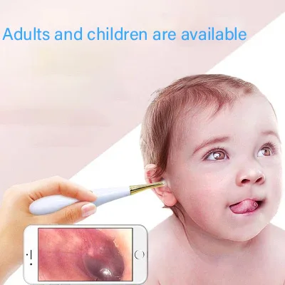 

2 million hd WIFI visible ear, nose and throat endoscope ear canal camera, mobile phone and computer universal otoscope