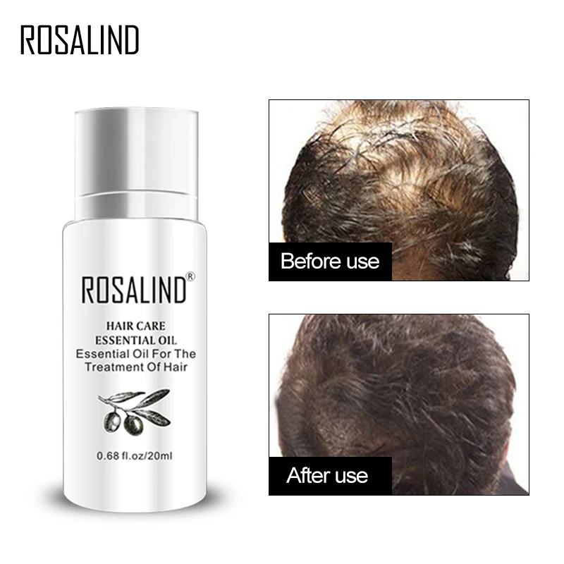Сыворотка для волос ROSALIND 20 мл кератиновая маска лечения выпадения питающая кожу