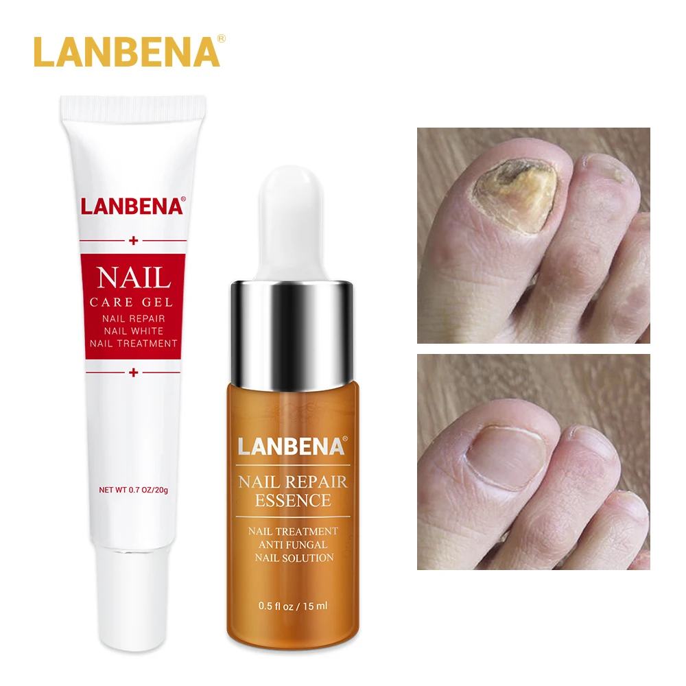 LANBENA гель для ухода за ногтями + эссенция восстановления ногтей Сыворотка лечения