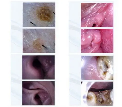 ЛОР Интраоральная Камера с 3 0 дюймов ЖК дисплей монитор|intraoral camera|camera intraoralcameras camera