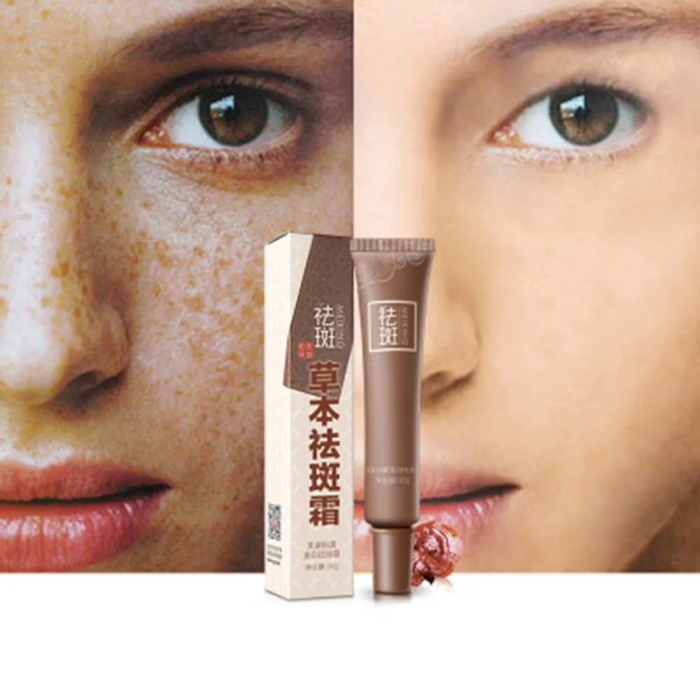 Натуральный Крем для красоты лица безопасный устраняет веснушки крем меланин