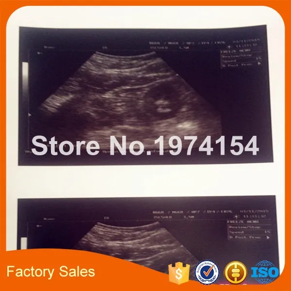 2X Rolls ultrasound UPP 110S 110mm*20m B-recorder UPP-110S thermal paper printer b-sheets A6 | Компьютеры и офис