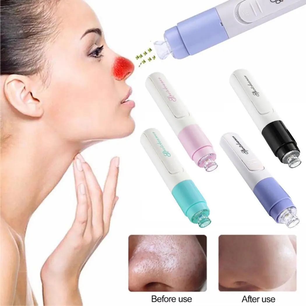 Очиститель для массажа с палочками сала и лица Cutin Acne Clear comedones cutin Pure 1 Blackhead x