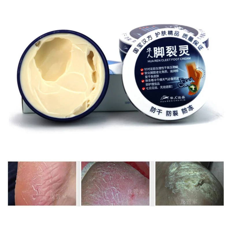 Chinese Traditional Medicine Anti Dry Crack Foot Care Cream Repair Hand Cracked Heel Anti-inflammatory Peeling Balm | Красота и