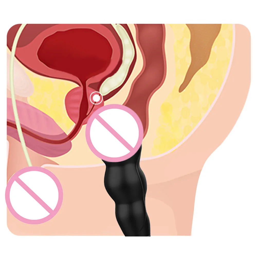 Silicone Male Masturbator Prostate Massage Anal Plug Stimulator Butt Sex Toys for Men Cock Ring Delay Erotic |