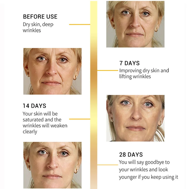 SOMILD Сыворотка для лица Корея антивозрастной контроль масла против морщин