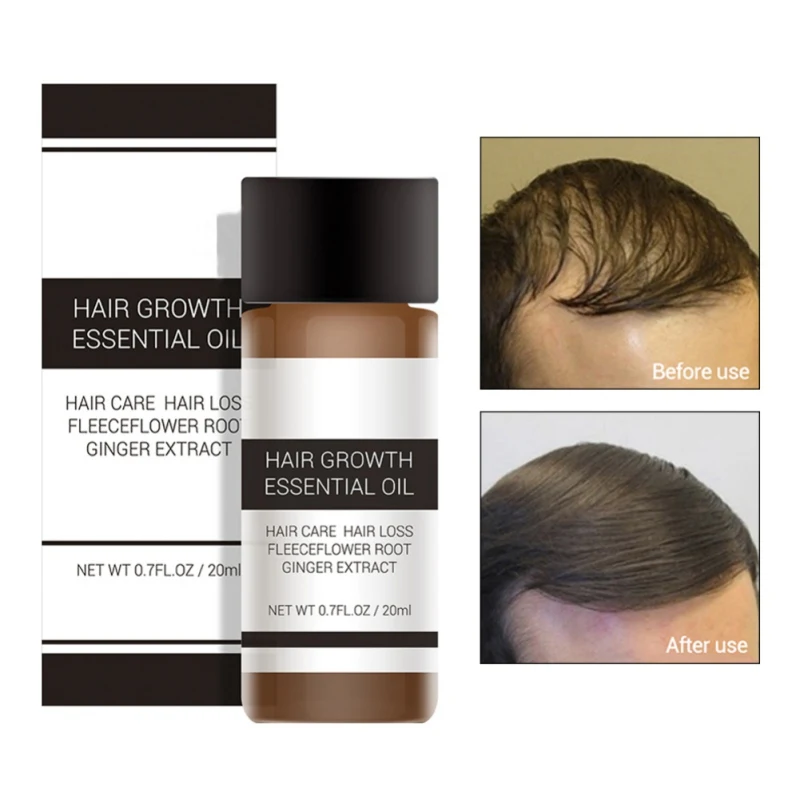 Fast Powerful Hair Growth Essence Products Essential Oil Liquid Treatment Preventing Loss Care 20ml | Красота и здоровье