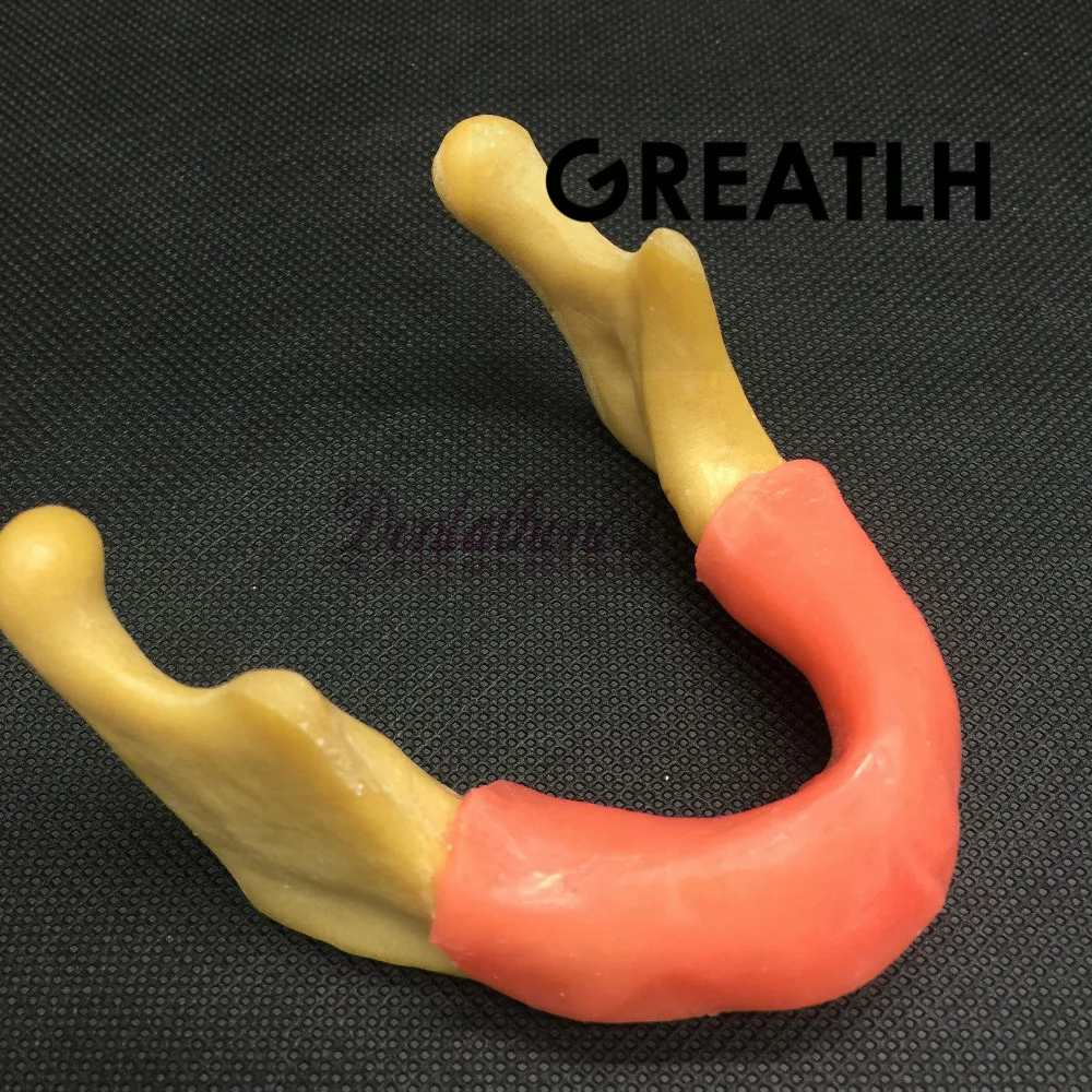 

Dental Mandible Implant Model Training Tool With Soft Tissue for