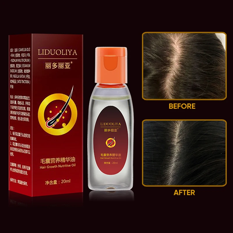 

Hair Growth Anti Hair Loss Liquid Promote Thick Fast Hair Growth Treatment 20ml Essential Oil Health Care Beauty Essence