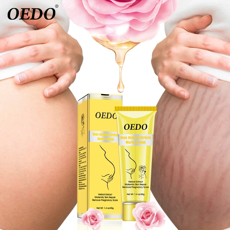 Крем OEDO Rose Для Удаления растяжек против старения для восстановления кожи