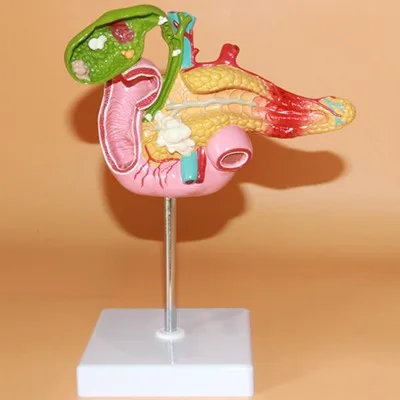 

pancreas Duodenum model Gallbladder pathological model Medical Teaching free shipping
