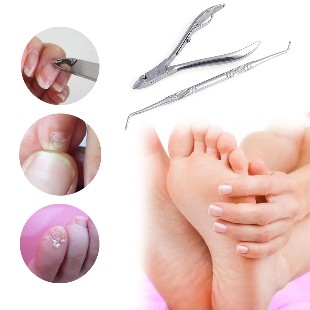 2Pcs/Set new Manicure Pedicure Tools Ingrown Toe Nail Correction Cuticle Pusher Dead Skin Dirt Remover Nail Nipper Clipper