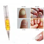 Новый анти онихомикоз кутикулы масло для ногтей инфекция для ухода за ногтями ремонт жидких ногтей ручка для лечения ногтей Лечение
