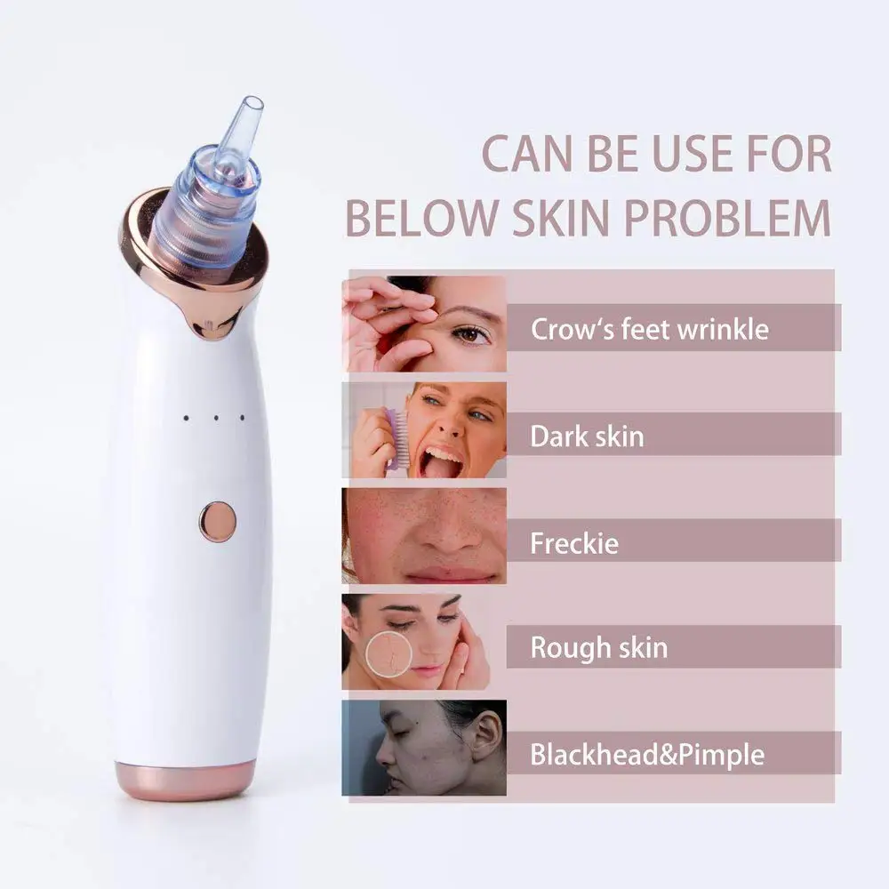 Beauty Comedo вакуумный отсос для угрей удаления алмазной дермабразии удаление