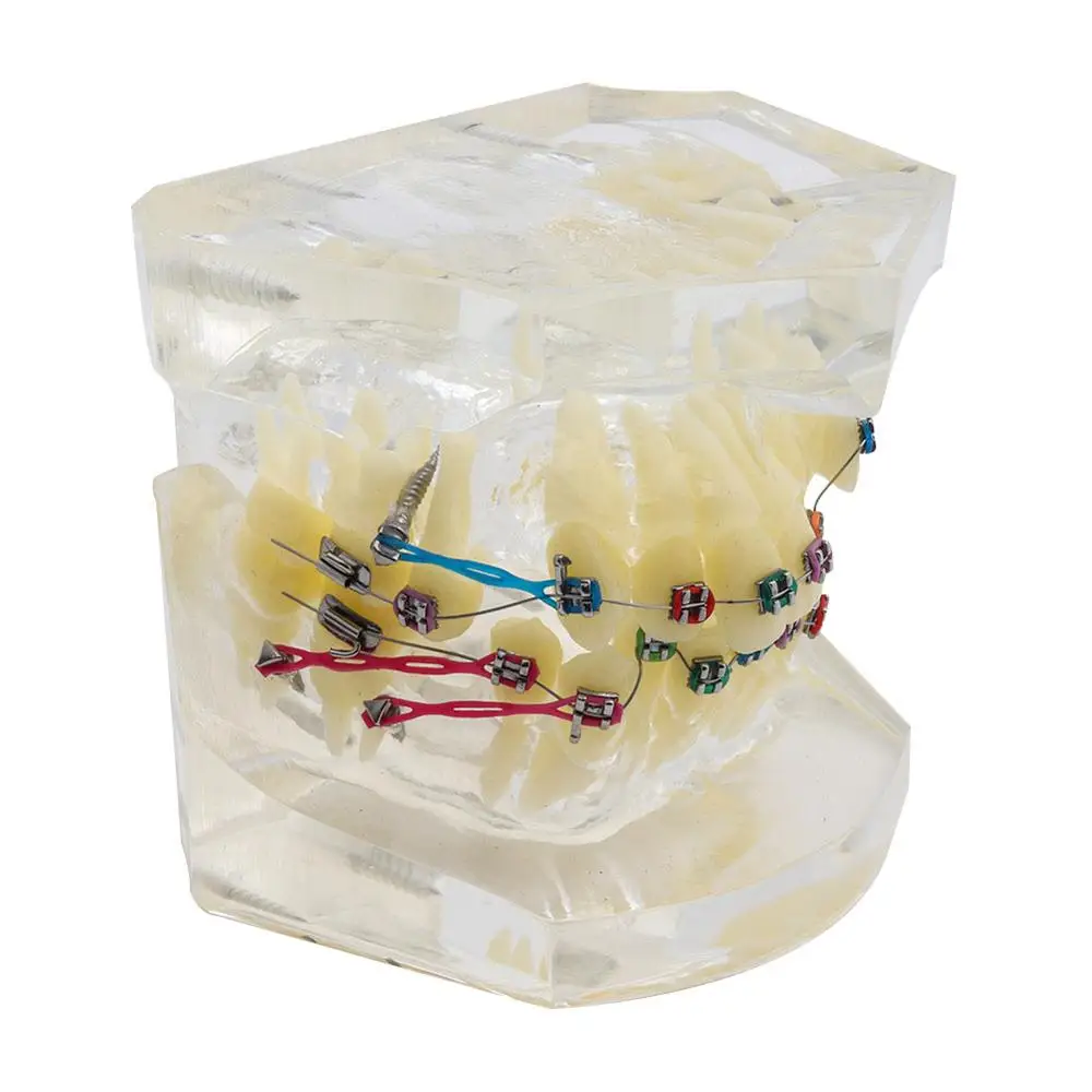 Стоматологическая стандартная Ортодонтическая модель зубов с кронштейнами