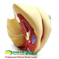 enovo medical human female reproductive system model uterus model obstetrics and gynecology anatomy family planning