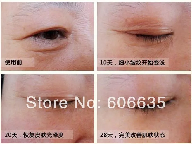 

2014 free ship Clostridium botulinum anti finelines wrinkle anti-wrinkle firming serum young skin moisturizing