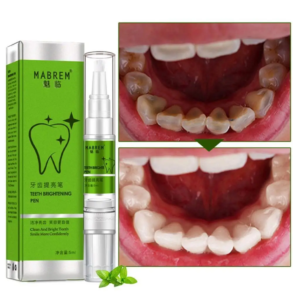 Зубной карандаш для придания блеска гигиены полости рта эссенция зубов