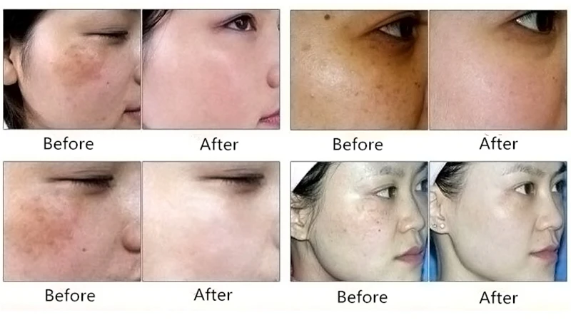 Dimollaure средство по уходу за кожей искусственное эфирное масло кожа хлоазма