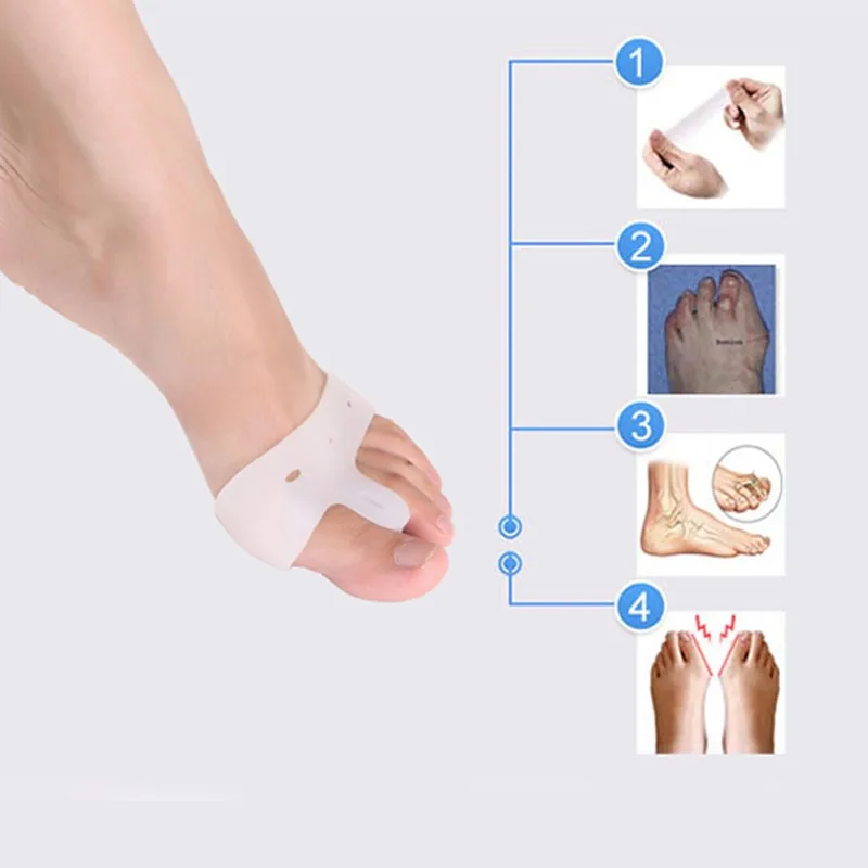 

15pair Toe Valgus Correction Separator Silicone Bunion Protector Harmmer Toe Spacer for Forefoot Cushion Foot Rubbing Pads