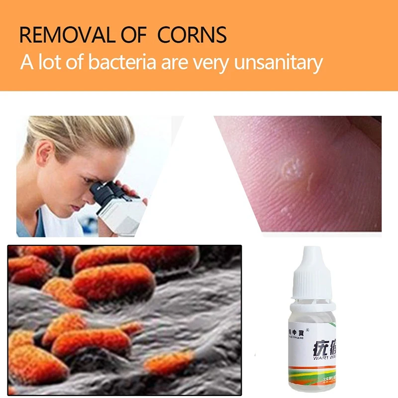 Body Warts Treatment Cream Skin Tag Remover Foot Corn Removal Plantar Genital Ointment Care 10ML |