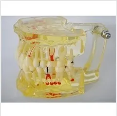 

Dental material Oral tooth pathology model free shipping