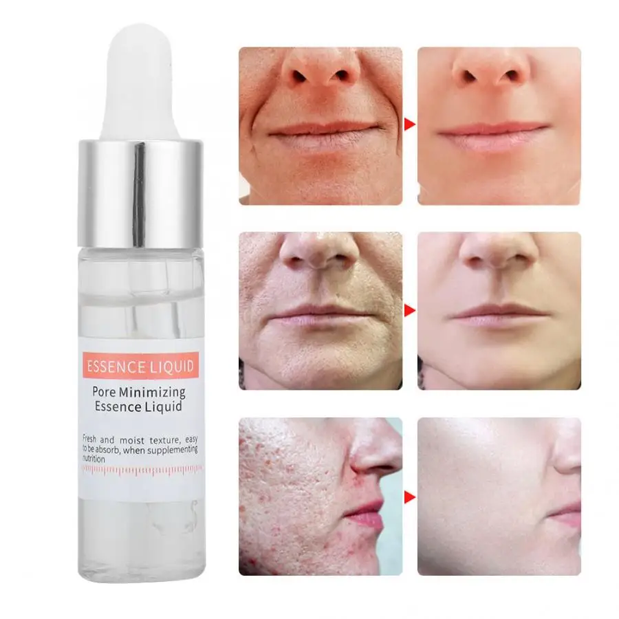 

Раствор салициловой кислоты сужает поры против морщин Увлажняющая сыворотка уход за кожей лица Жидкость 15 мл