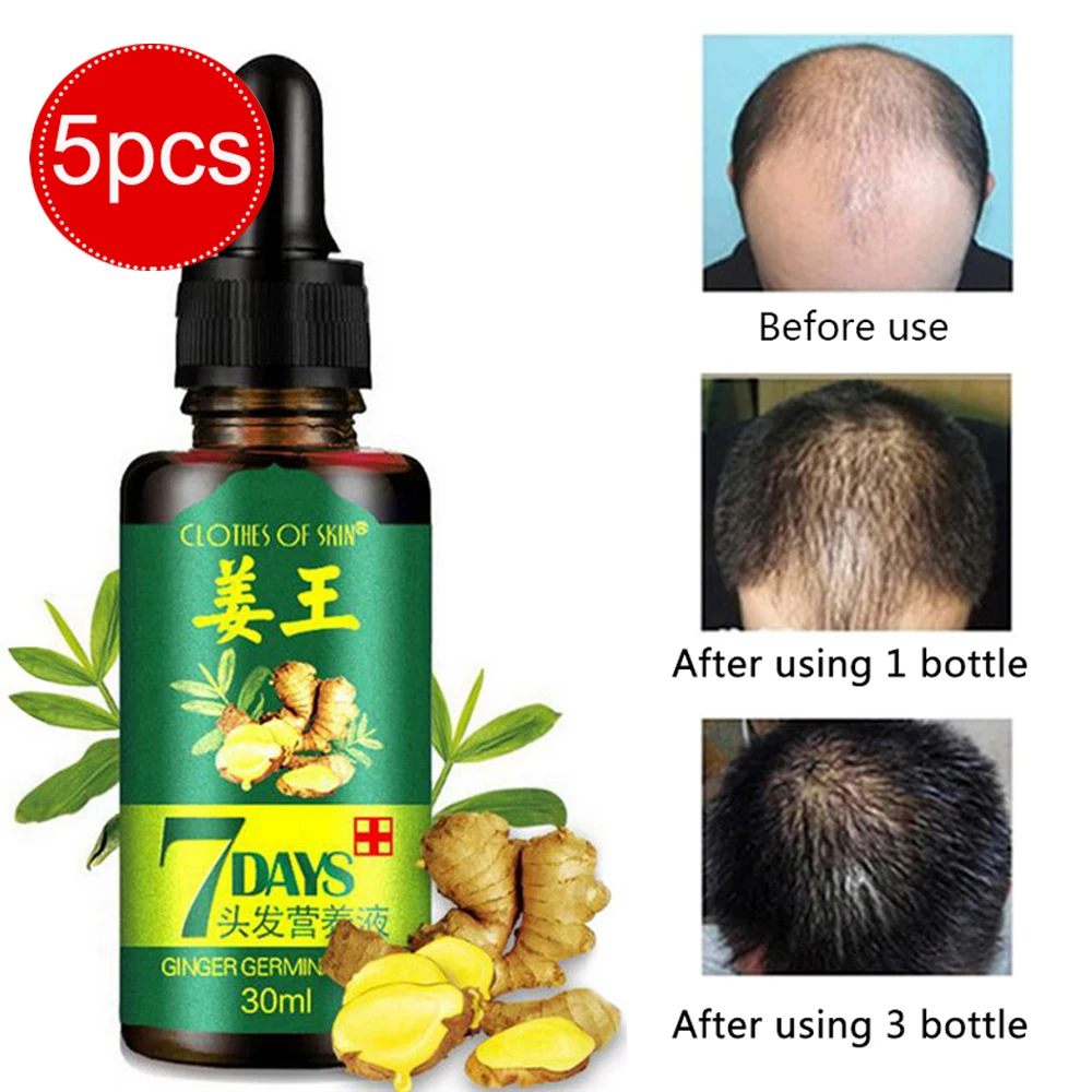 5 шт./компл. эссенция для роста волос жидкость выпадения чистое Оригинальное
