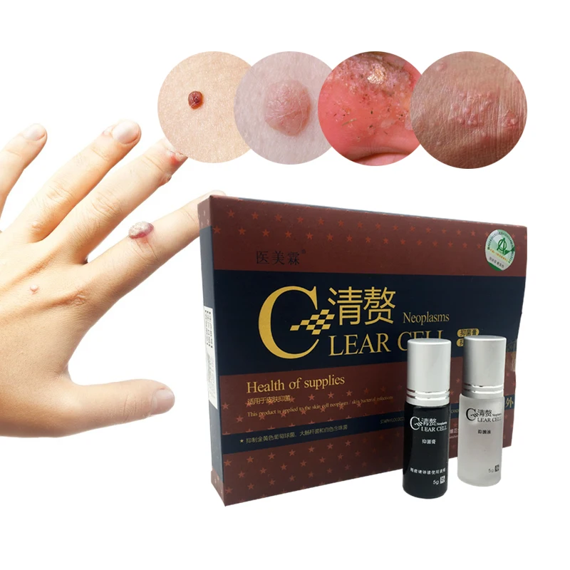 Оригинальные китайские лекарственные средства для удаления веснушек морщин и