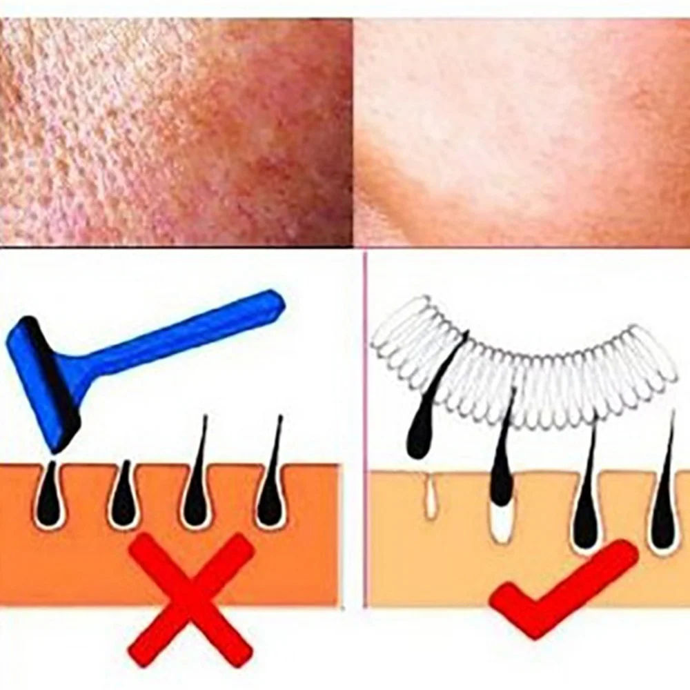 5 шт. Лидер продаж Ручная лицевая для удаления волос лазерный Эпилятор Epistick