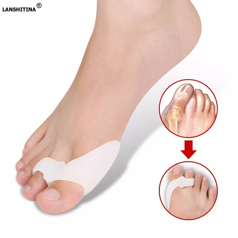 Аксессуары для обуви Стельки силиконовые Hallux вальгус палец ноги разделитель для коррекции Установить ночь с ортезом