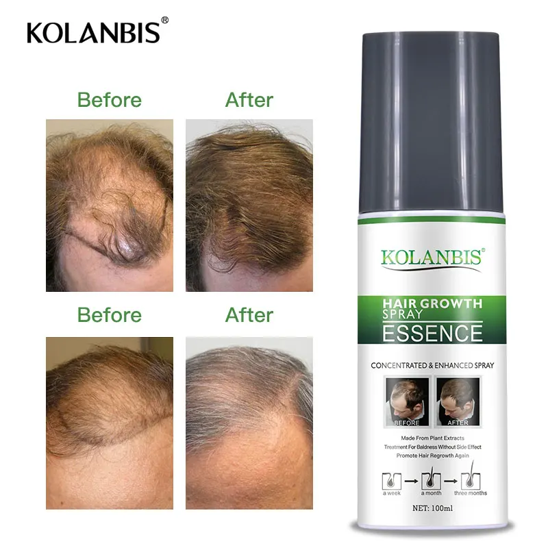 Сыворотка для быстрого роста волос густая долговечная полное масло Alopecia