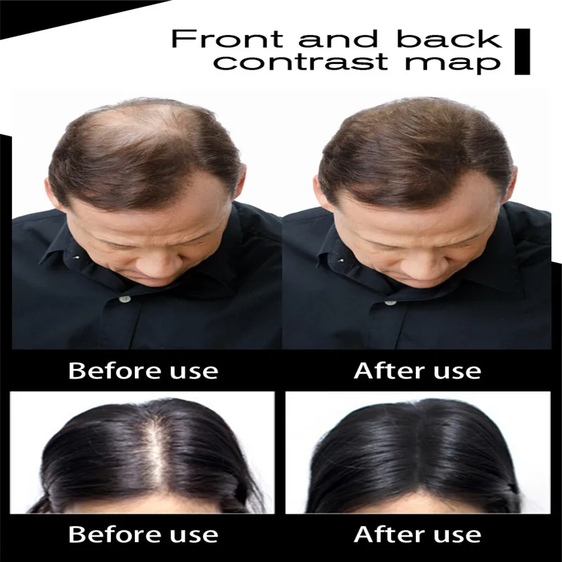 

Hair Loss Fiber 27.5g Hair Fibers Refill Powder Hair Loss Building Hairline Optimizer Dense Hair Growth Authentic Keratin