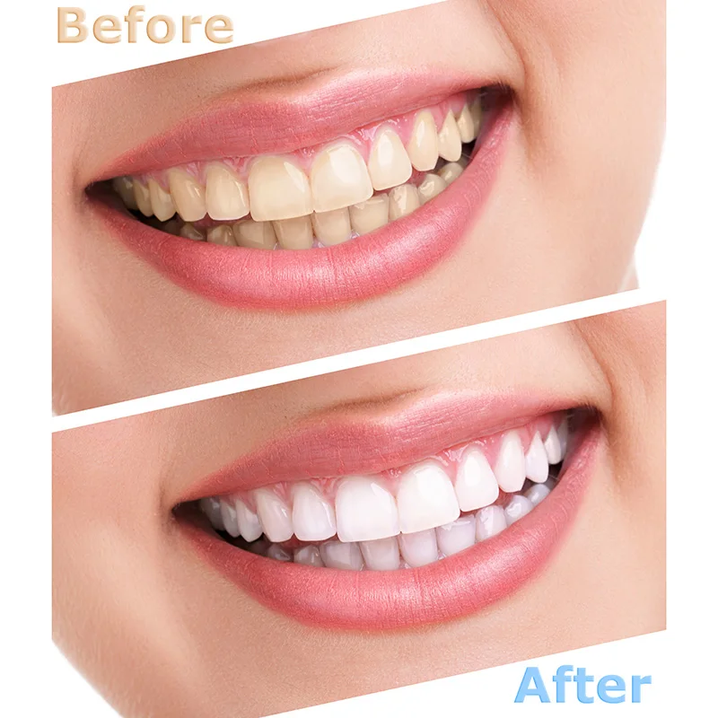 

Dropshipping Teeth Whitening Powder Natural Activated Charcoal Teeth Whitening 45g SMJ