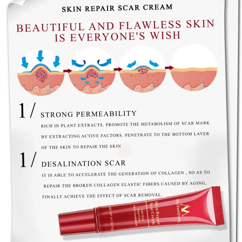 

15g Acne Scar Removal Cream Acne Spots Acne Treatment Blackhead Whitening Cream Anti Scar Stretch Skin Repair Face Cream