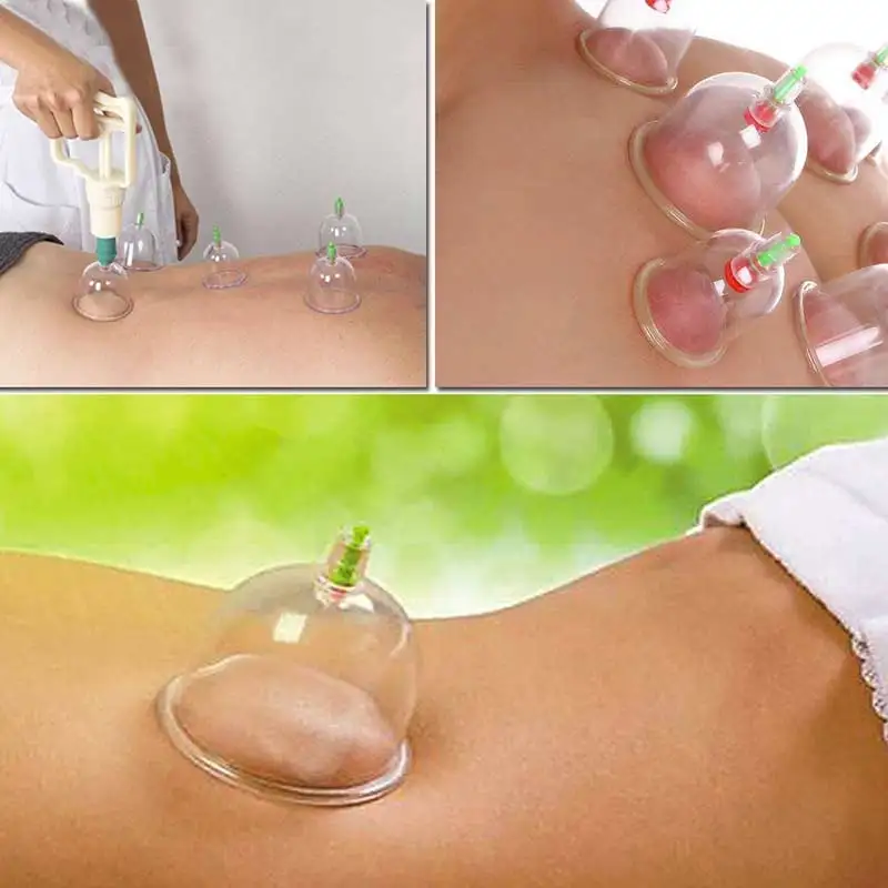 6 шт./компл. медицинские вакуумные банки для расслабления тела с насосом на