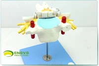 enovo the anatomical model of the nerve orthopedics of the cervical spinal cord and spinal nerve