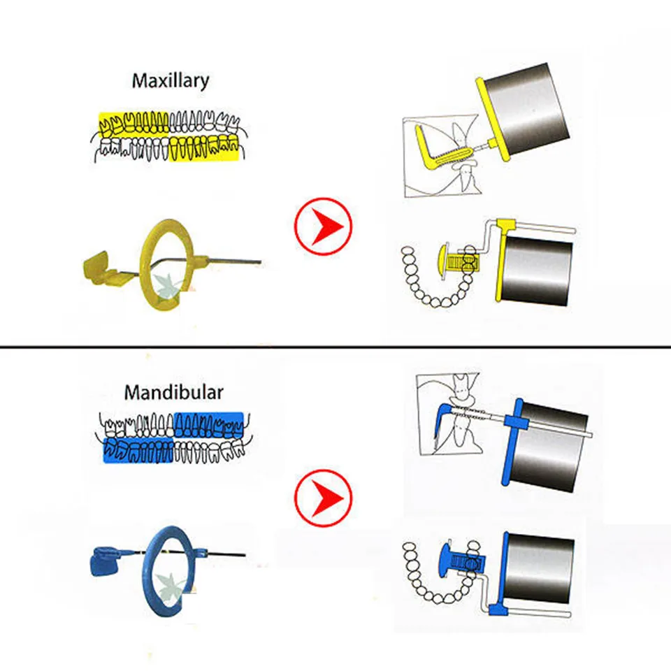 Продажа 1 компл. Рентгеновский фильм позиционирования системы позиционер